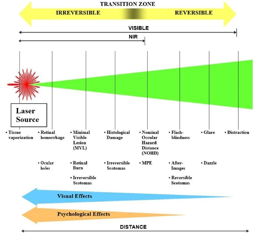 43 Ocular Evaluation And Disposition After Suspected Laser Exposure