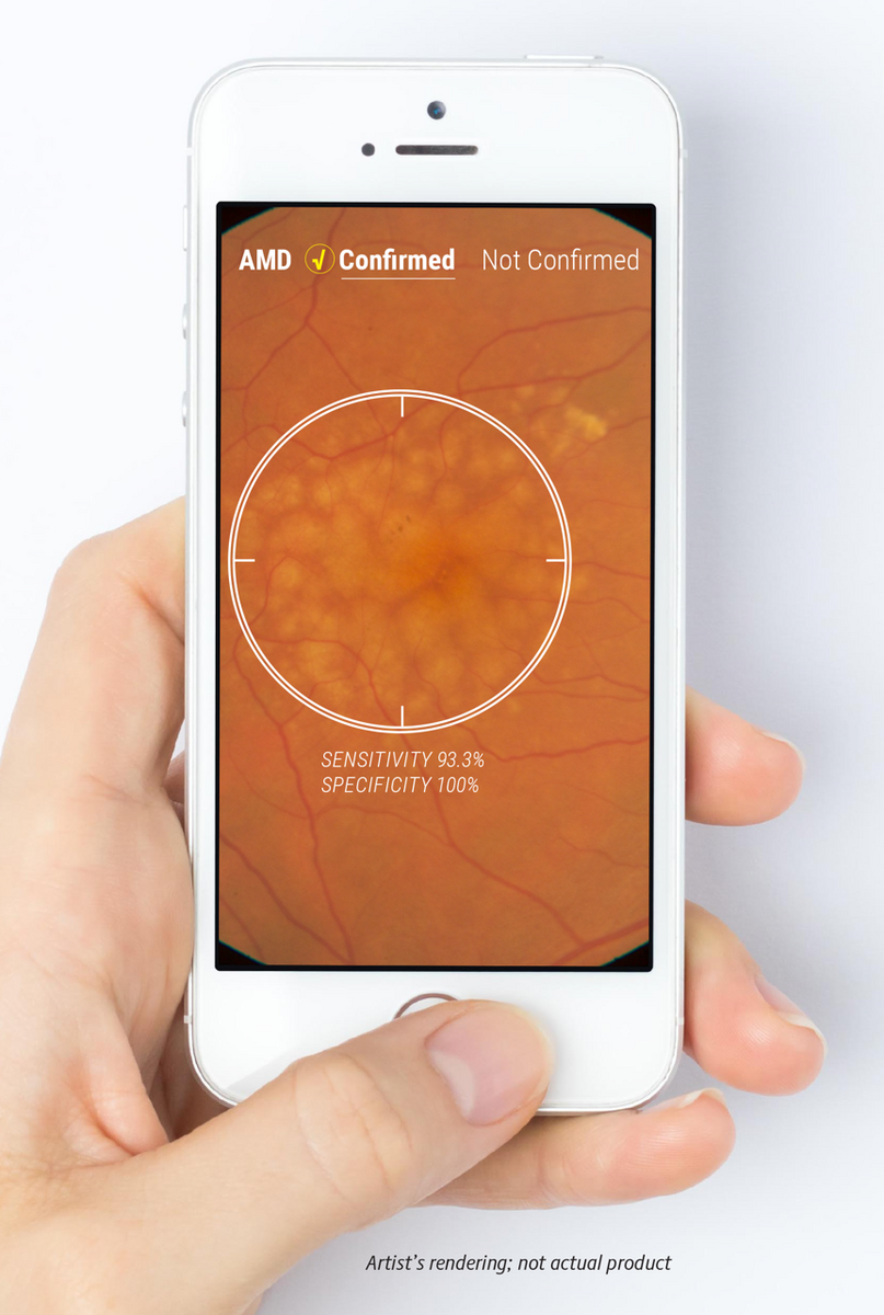 AMD Screening There S Going To Be An App For That AMD Screening There S Going To Be An App For That