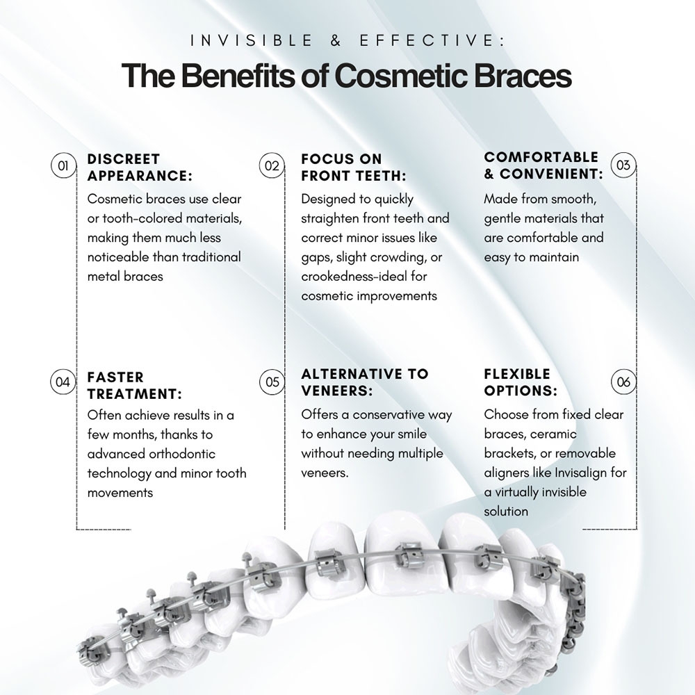 Cosmetic Braces Get Straighter Teeth In Just A Few Months Cosmetic Braces Get Straighter Teeth In Just A Few Months