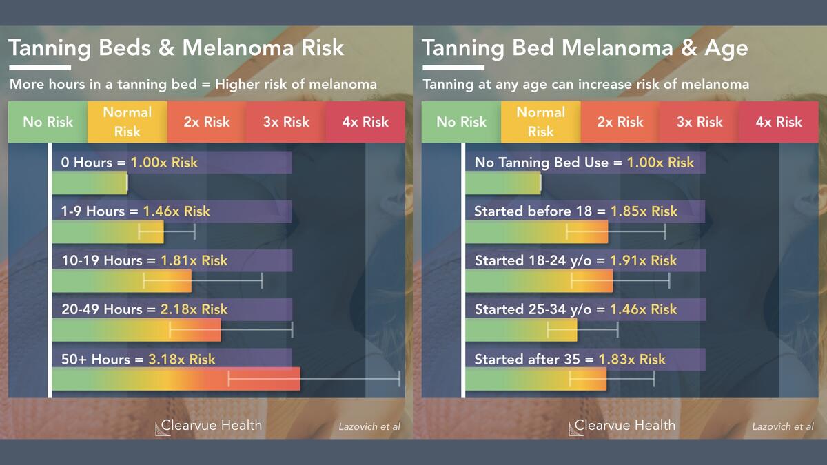 Data On Tanning Beds And Melanoma Visualized Health