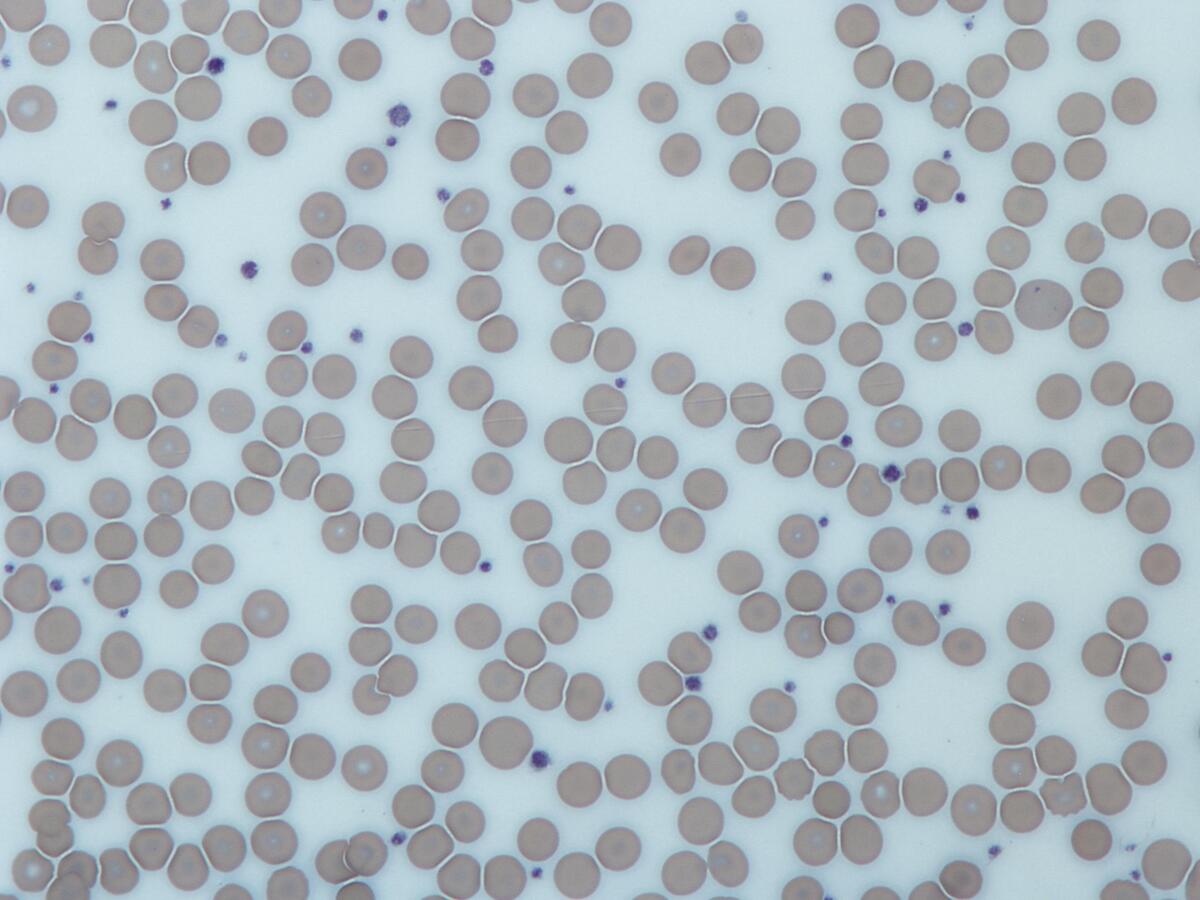 Platelet Wikipedia Platelet Wikipedia
