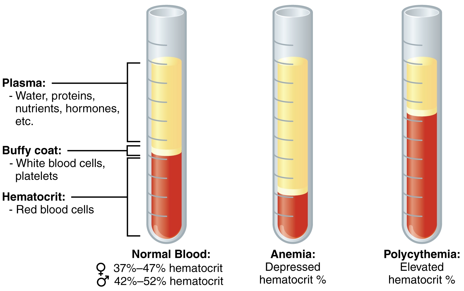 Polycythemia Wikipedia
