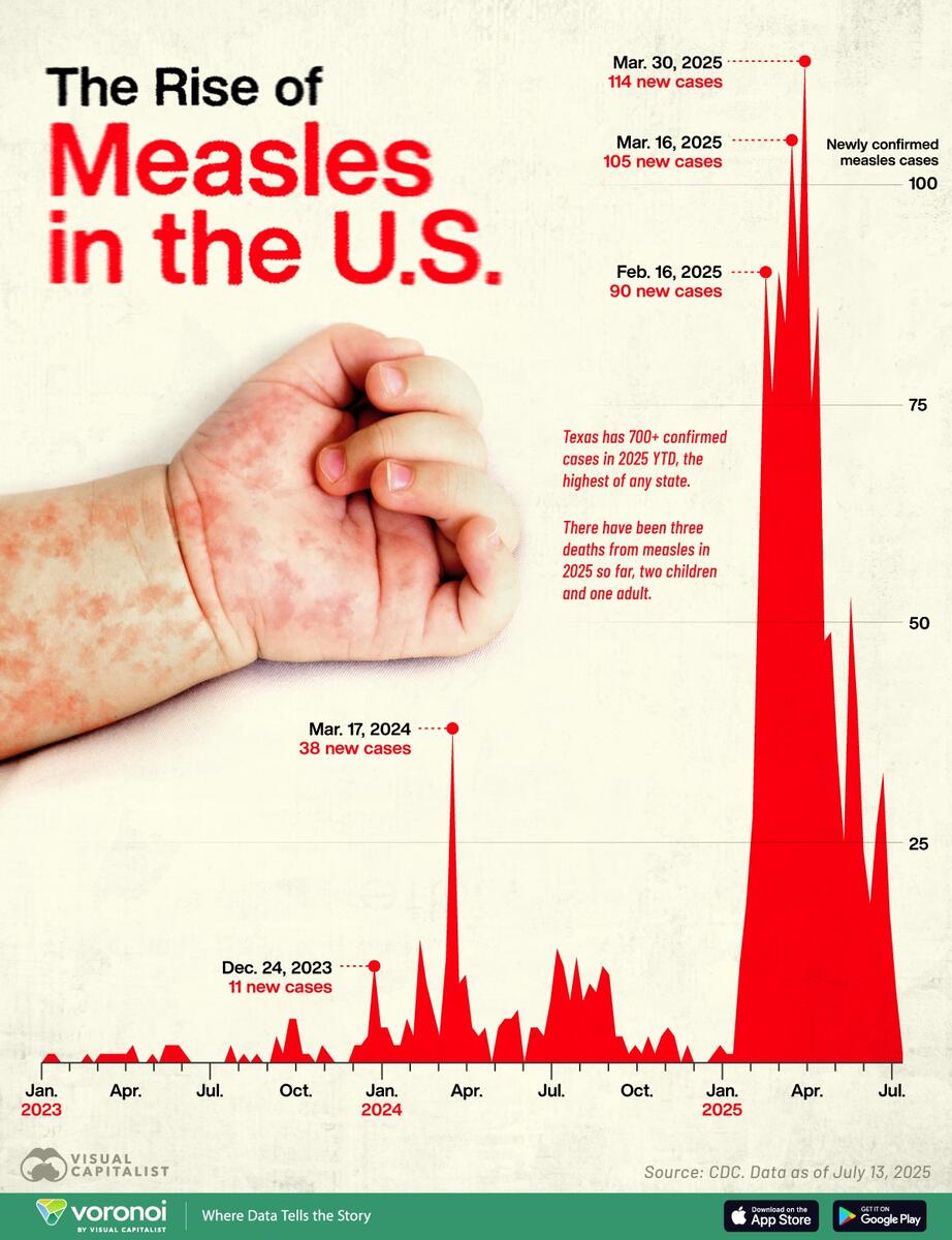 Visualized America S Surge In Measles Cases In 2025